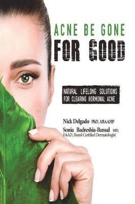 Acne Be Gone for Good by Nick Delgado Phd image