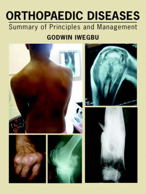 Orthopaedic Diseases by Godwin, Iwegbu image