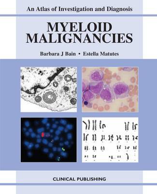 Myeloid Malignancies image