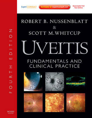 Uveitis by Robert B. Nussenblatt image