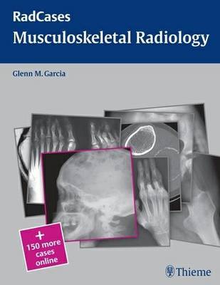 Radcases Musculoskeletal Radiology image