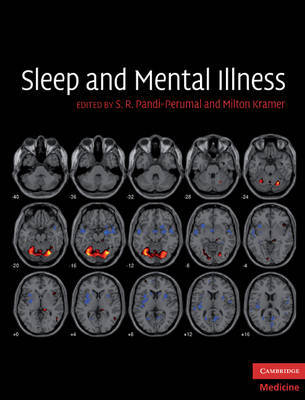 Sleep and Mental Illness image