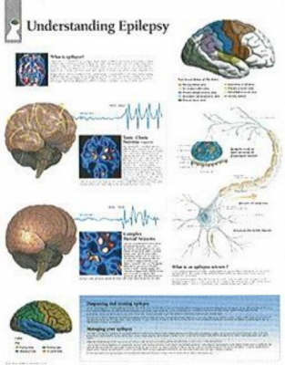 Understanding Epilepsy by Scientific Publishing image