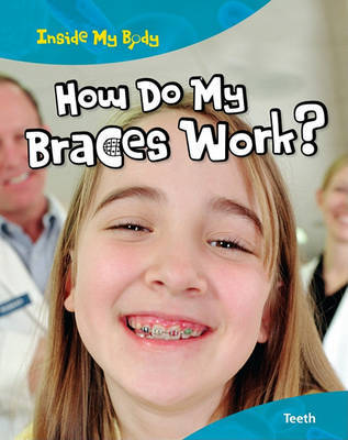 How Do My Braces Work? on Hardback by Steve Parker