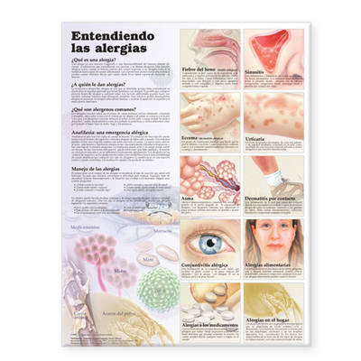 Understanding Allergies Anatomical Chart in Spanish (Entendiendo Las Alergias) image