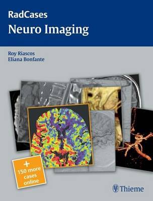 Radcases Neuro Imaging image