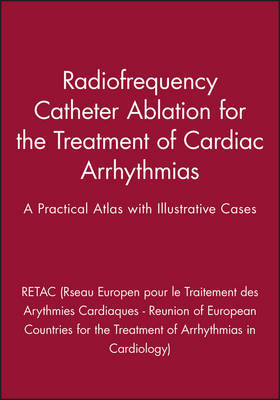 Radiofrequency Catheter Ablation for the Treatment of Cardiac Arrhythmias image