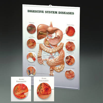 Digestive System Diseases image