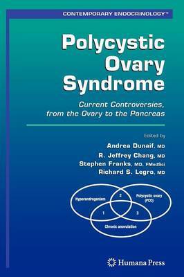 Polycystic Ovary Syndrome image