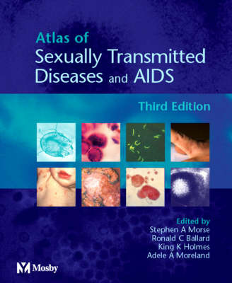 a description of sexually transmitted diseases Sexually transmitted diseases (stds) are some of the most commonly reported diseases in the united states it is estimated that there are almost 20 million new std infections each year in the united states. a description of sexually transmitted diseases Sexually transmitted diseases (stds) are some of the most commonly reported diseases in the united states it is estimated that there are almost 20 million new std infections each year in the united states.