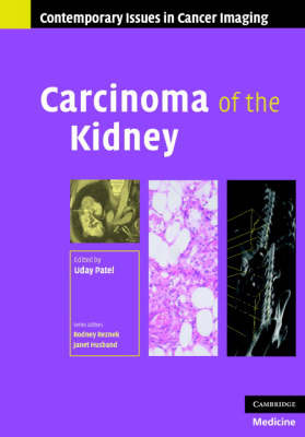 Carcinoma of the Kidney on Hardback