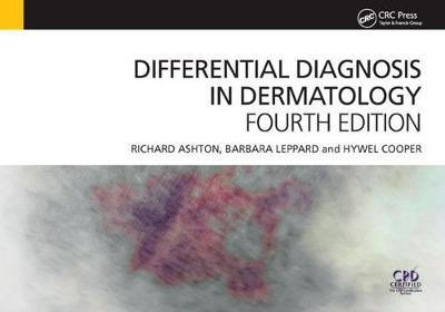Differential Diagnosis in Dermatology, 4th Edition by Richard Ashton image