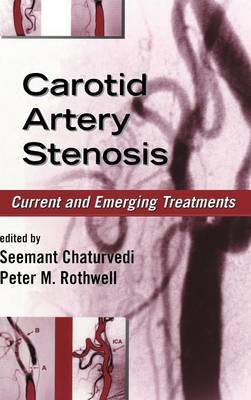 Carotid Artery Stenosis image