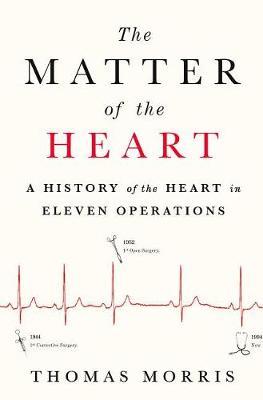 The Matter of the Heart by Thomas Morris image