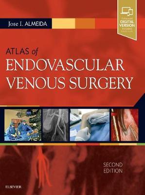 Atlas of Endovascular Venous Surgery by Jose Almeida image