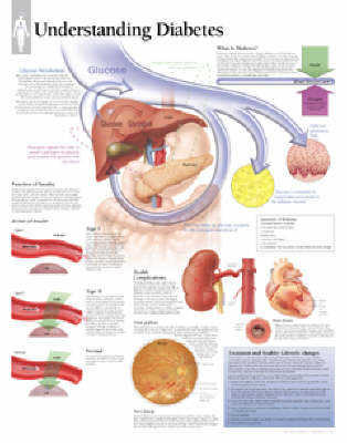 Understanding Diabetes by Scientific Publishing image