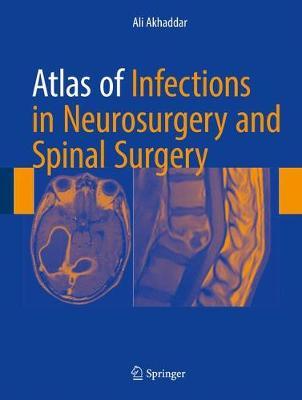 Atlas of Infections in Neurosurgery and Spinal Surgery image