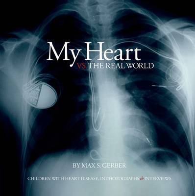 My Heart Vs. the Real World by Max S. Gerber image
