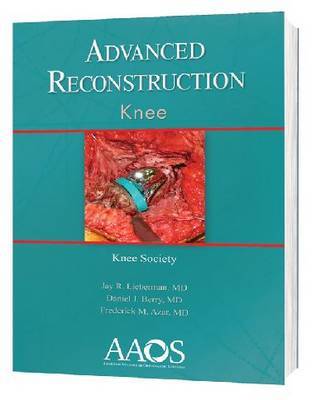 Advanced Reconstruction: Knee by Jay R. Lieberman image