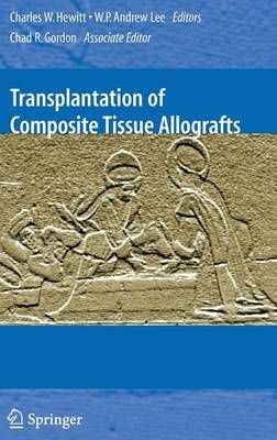 Transplantation of Composite Tissue Allografts image