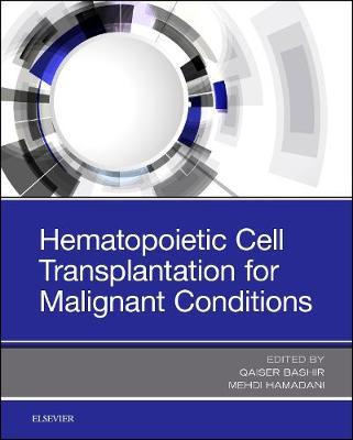 Hematopoietic Cell Transplantation for Malignant Conditions image