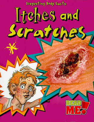 Itches and Scratches by Angela Royston image