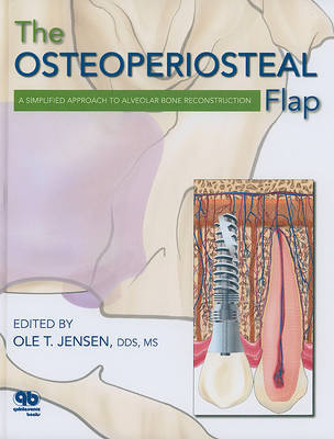 The Osteoperiosteal Flap by OLE T Jensen image