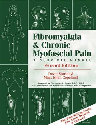 Fibromyalgia And Chronic Myofascial Pain image