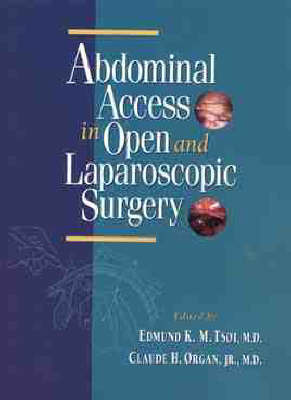 Abdominal Access in Open and Laparoscopic Surgery image