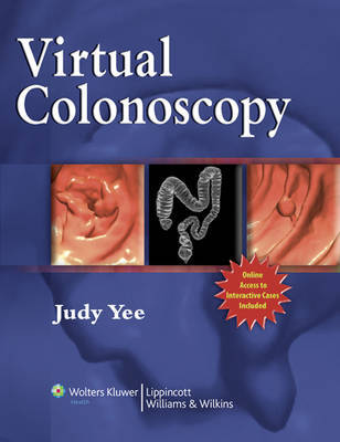 Virtual Colonoscopy image