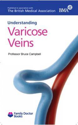 Understanding Varicose Veins by Bruce Campbell image