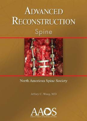 Advanced Reconstruction: Spine on Hardback