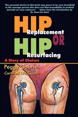 Hip Replacement or Hip Resurfacing: A Story of Choices by Peggy Gabriel image