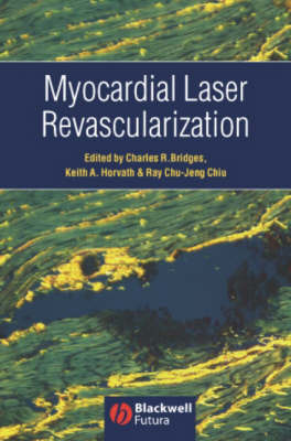 Myocardial Laser Revascularization image