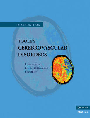 Toole's Cerebrovascular Disorders on Hardback by E. Steve Roach