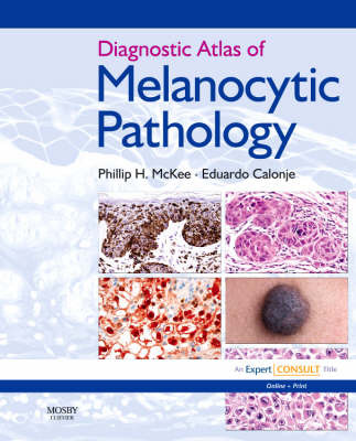 Diagnostic Atlas of Melanocytic Pathology by J. Eduardo Calonje image