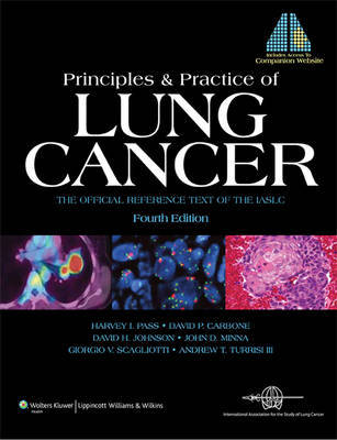 Principles and Practice of Lung Cancer image