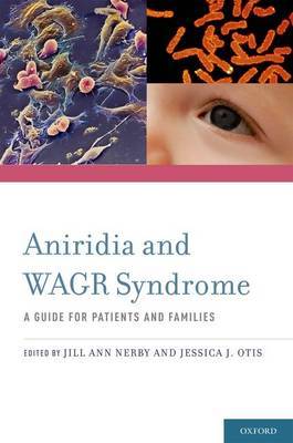 Aniridia and WAGR Syndrome image