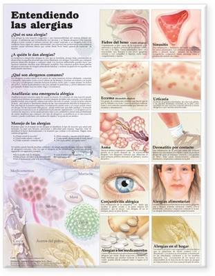 Understanding Allergies Anatomical Chart in Spanish (Entendiendo Las Alergias) image