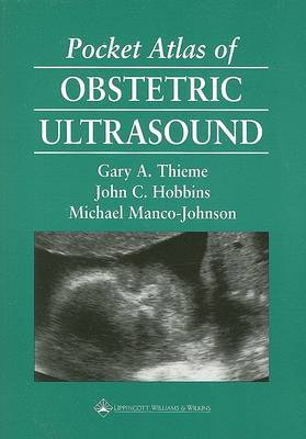 Pocket Atlas of Obstetric Ultrasound by G.A. Thieme image