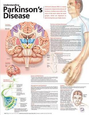 Understanding Parkinson's Disease Anatomical Chart image