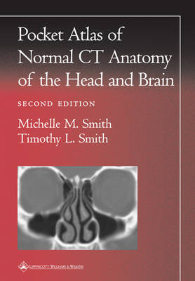 Pocket Atlas of Normal CT Anatomy of the Head and Brain by Michelle M. Smith