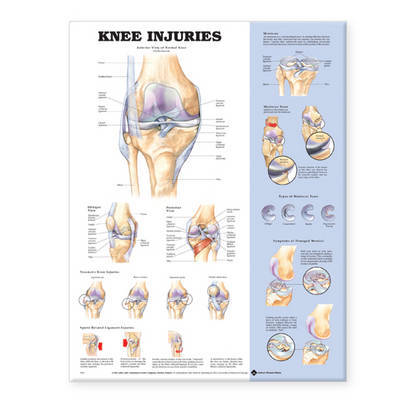 Knee Injuries Anatomical Chart image