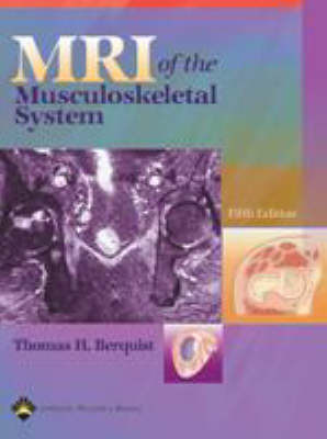 MRI of the Musculoskeletal System image