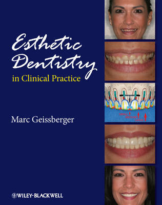 Esthetic Dentistry in Clinical Practice on Hardback by Marc Geissberger