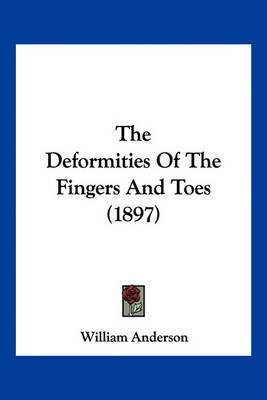 The Deformities of the Fingers and Toes (1897) by William Anderson image