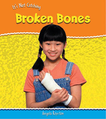 Broken Bones by Angela Royston image