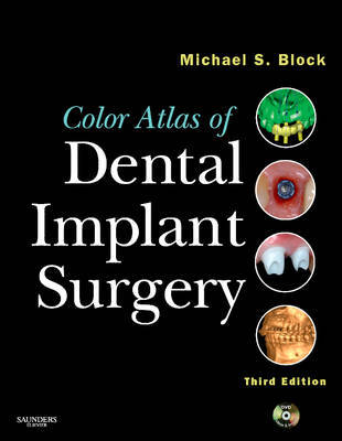 Color Atlas of Dental Implant Surgery by Michael S Block image