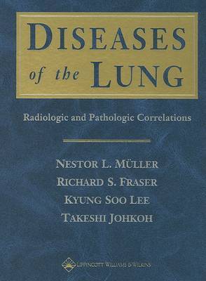 Diseases of the Lung image