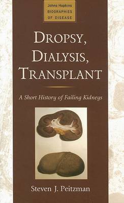 Dropsy, Dialysis, Transplant by Steven J. Peitzman image